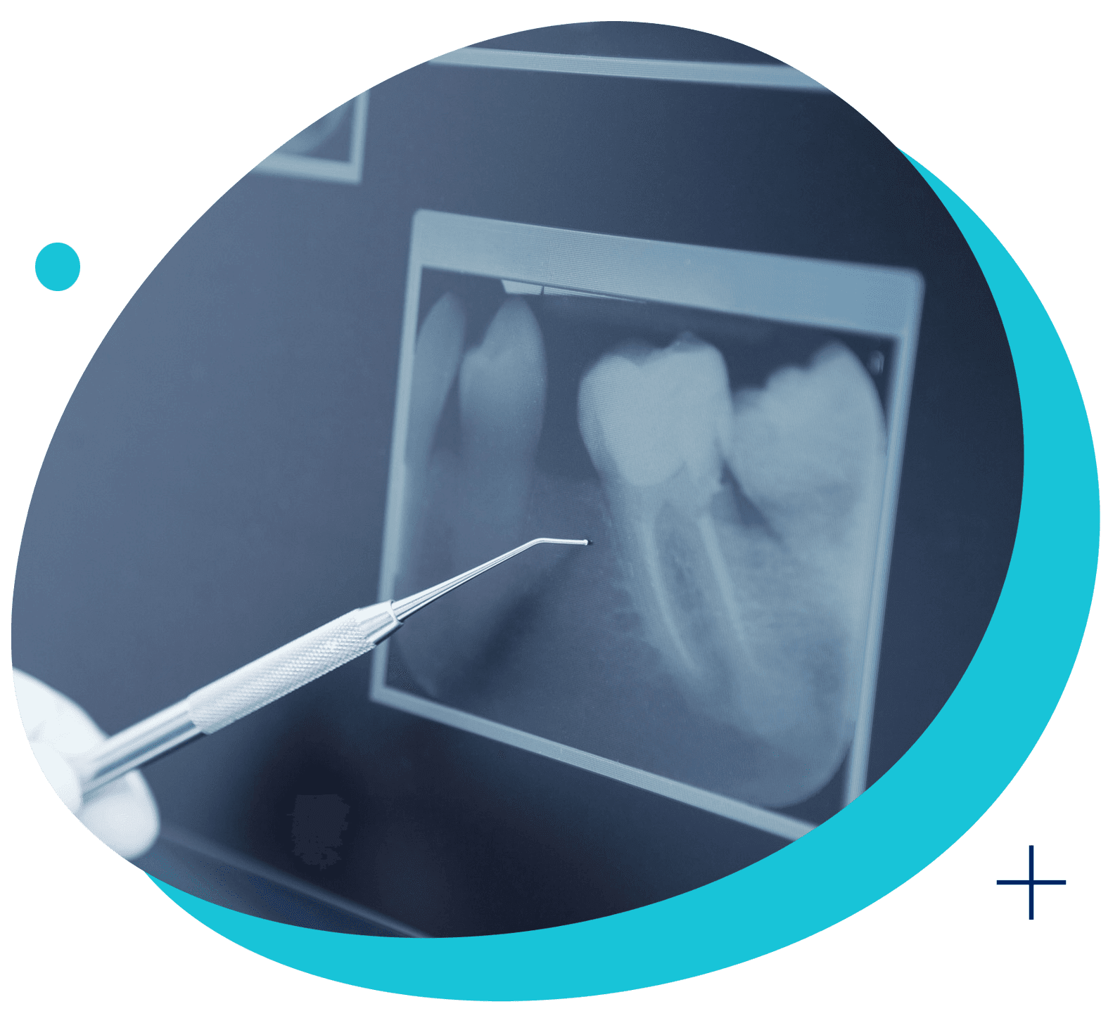 Failed Root Canal Pain Relief Long Island