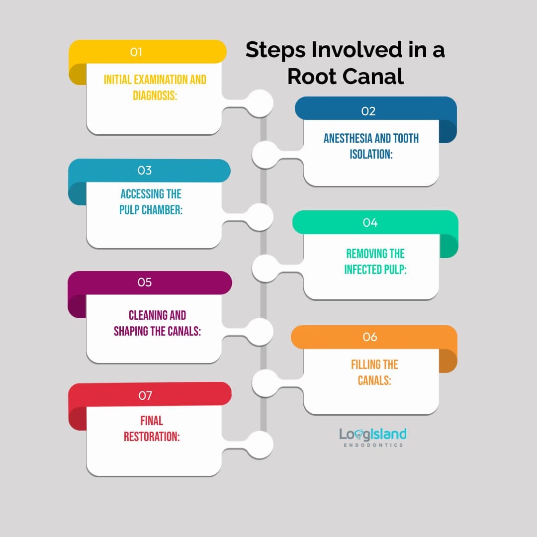 Steps Involved in a Root Canal
