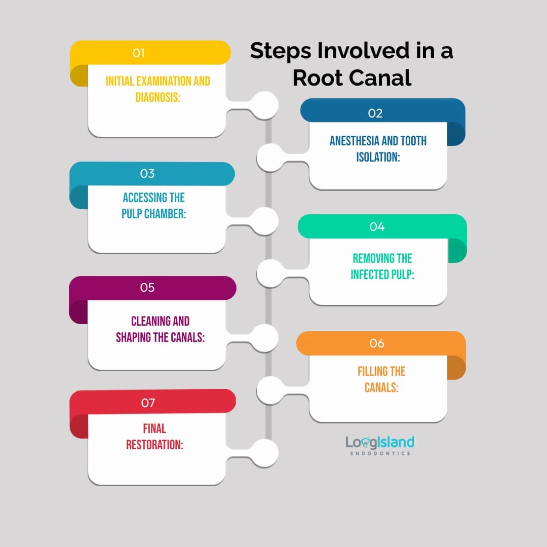 Steps Involved in a Root Canal 